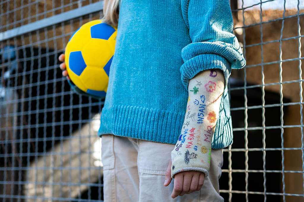 Kids signing a child’s cast at school