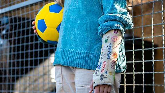 Kids signing a child’s cast at school